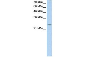 WB Suggested Anti-C5orf4 Antibody Titration:  0. (C5ORF4 Antikörper  (N-Term))