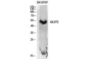 Western Blotting (WB) image for anti-Solute Carrier Family 2 (Facilitated Glucose Transporter), Member 3 (SLC2A3) (C-Term) antibody (ABIN3175292) (SLC2A3 Antikörper  (C-Term))