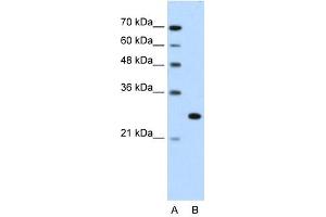 Western Blot showing FOXR2 antibody used at a concentration of 1-2 ug/ml to detect its target protein. (FOXR2 Antikörper  (N-Term))