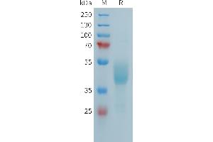 Human F(752-834) Protein, hFc Tag on SDS-PAGE under reducing condition. (FCRL5 Protein (AA 752-834) (Fc Tag))