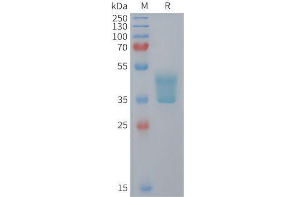 CCR2 Protein (AA 1-55) (Fc Tag)