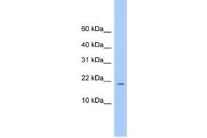 WB Suggested Anti-C10orf83 Antibody Titration: 0. (MORN4 Antikörper  (Middle Region))
