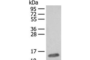 Western blot analysis of Mouse heart tissue lysate using FABP4 Polyclonal Antibody at dilution of 1:400 (FABP4 Antikörper)