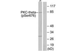 Western Blotting (WB) image for anti-Protein Kinase C, theta (PRKCQ) (pSer676) antibody (ABIN2888514) (PKC theta Antikörper  (pSer676))