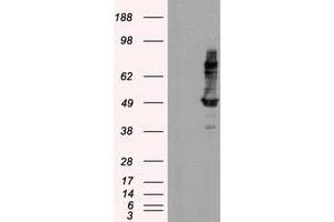 Image no. 2 for anti-Intraflagellar Transport 57 Homolog (IFT57) antibody (ABIN1498809) (IFT57 Antikörper)