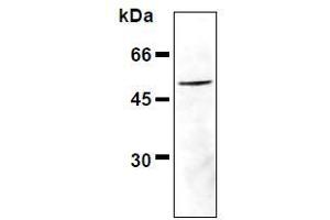 Western Blotting (WB) image for anti-Vimentin (VIM) (pSer33) antibody (ABIN1449152) (Vimentin Antikörper  (pSer33))