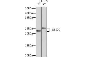 Western blot analysis of extracts of various cell lines, using UBE2C Rabbit mAb (ABIN1680590, ABIN3019392, ABIN3019393 and ABIN7101768) at 1:1000 dilution. (UBE2C Antikörper)
