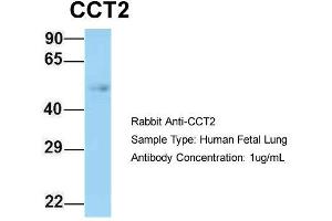 Host: Rabbit  Target Name: CCT2  Sample Tissue: Human Fetal Lung  Antibody Dilution: 1. (CCT2 Antikörper  (N-Term))