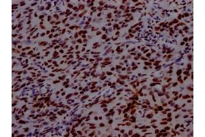 Immunohistochemistry (IHC) image for anti-Poly A Binding Protein Nuclear 1 (PABPN1) antibody (ABIN7127661)