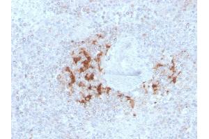 Formalin-fixed, paraffin-embedded human Spleen stained with TRAF1 Mouse Monoclonal Antibody (TRAF1/3298). (TRAF1 Antikörper  (AA 73-219))