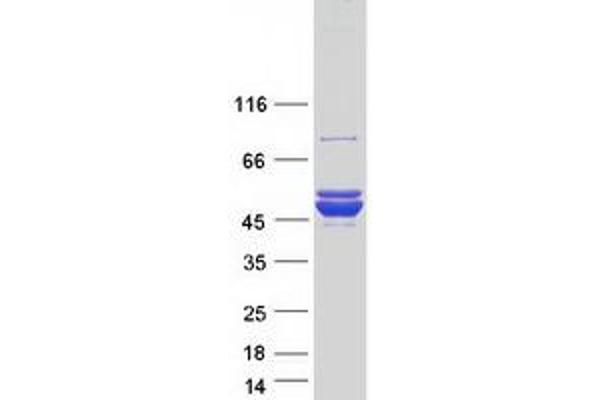 ACOT9 Protein (Transcript Variant 1) (Myc-DYKDDDDK Tag)