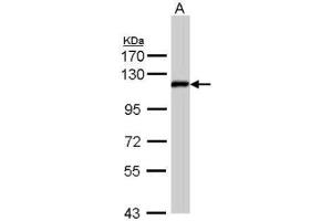 WB Image Sample (30 ug of whole cell lysate) A: Hep G2 , 7. (ZHX2 Antikörper  (C-Term))