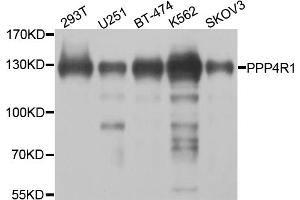 Western blot analysis of extracts of various cell lines, using PPP4R1 antibody (ABIN5974671) at 1/1000 dilution. (PPP4R1 Antikörper)
