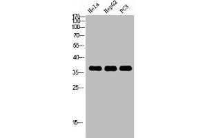 Western Blot analysis of HELA HEPG2 PC-3 using p38 Polyclonal Antibody. (MAPK14 Antikörper  (C-Term))