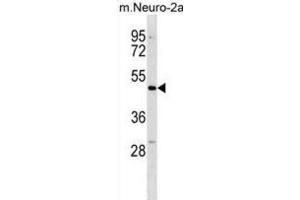 Western Blotting (WB) image for anti-Doublecortin Domain Containing 2 (DCDC2) antibody (ABIN3000420) (DCDC2 Antikörper)