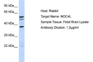 Host: Rabbit Target Name: NOC4L Sample Type: Fetal Brain lysates Antibody Dilution: 1. (NOC4L Antikörper  (N-Term))