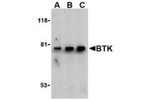 Image no. 2 for anti-Bruton Agammaglobulinemia tyrosine Kinase (BTK) (N-Term) antibody (ABIN206839) (BTK Antikörper  (N-Term))