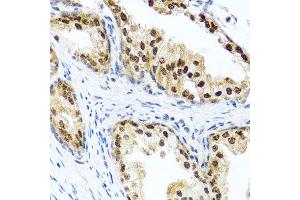 Immunohistochemistry of paraffin-embedded human prostate using RAD23B antibody. (RAD23B Antikörper  (AA 50-150))