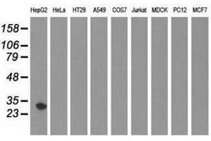 Image no. 2 for anti-Sulfotransferase Family, Cytosolic, 2A, Dehydroepiandrosterone (DHEA)-Preferring, Member 1 (SULT2A1) antibody (ABIN1501235) (SULT2A1 Antikörper)