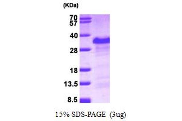 PAIP2 Protein (AA 1-127) (His tag)