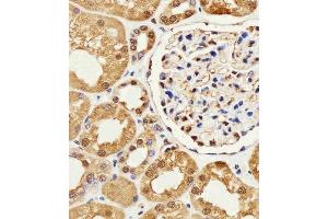 Immunohistochemistry (Paraffin-embedded Sections) (IHC (p)) image for anti-Glyceraldehyde-3-Phosphate Dehydrogenase (GAPDH) antibody (ABIN1539789)
