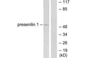 Western Blotting (WB) image for anti-Presenilin 1 (PSEN1) (N-Term) antibody (ABIN1848749) (Presenilin 1 Antikörper  (N-Term))