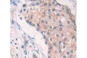 Used in DAB staining on fromalin fixed paraffin- embedded Kidney tissue (SRPK3 Antikörper  (AA 247-517))