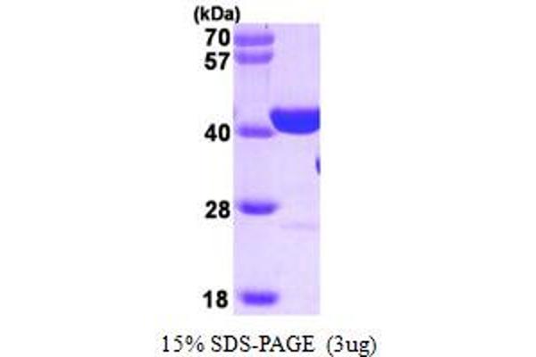 PARP1 Protein (AA 662-1014)