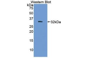 Detection of Recombinant DNMT1, Human using Polyclonal Antibody to DNA Methyltransferase 1 (DNMT1) (DNMT1 Antikörper  (AA 1343-1570))