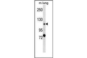 Western blot analysis of PKD2 Antibody (PKD2 Antikörper  (C-Term))