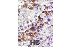 Immunohistochemistry (IHC) image for anti-Ubiquitin-Conjugating Enzyme E2E 3 (UBE2E3) antibody (ABIN3001488) (UBE2E3 Antikörper)