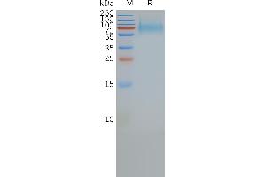 Human S-Nanodisc, His/Flag Tag on SDS-PAGE (SSTR2 Protein)