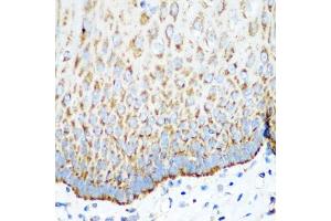 Immunohistochemistry of paraffin-embedded human esophagus using MT-CO2 antibody (ABIN4903355) at dilution of 1:100 (40x lens). (COX2 Antikörper)