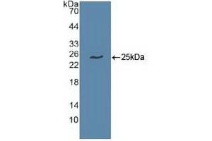 Detection of Recombinant UBE2C, Human using Polyclonal Antibody to Ubiquitin Conjugating Enzyme E2C (UBE2C) (UBE2C Antikörper  (AA 2-179))