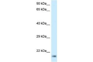 Western Blot showing RPL23A antibody used at a concentration of 1 ug/ml against Jurkat Cell Lysate (RPL23A Antikörper  (C-Term))