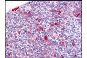 Human Tonsil: Formalin-Fixed, Paraffin-Embedded (FFPE) (Girdin Antikörper  (C-Term))