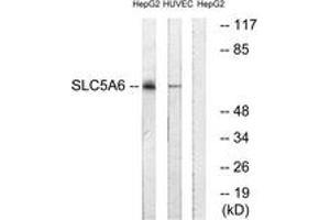 Western Blotting (WB) image for anti-Solute Carrier Family 5 (Iodide Transporter), Member 6 (SLC5A6) (AA 551-600) antibody (ABIN2890649) (SLC5A6 Antikörper  (AA 551-600))