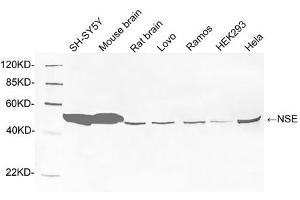 Western blot analysis of tissue and cell lysates using 1 µg/mL Rabbit Anti-NSE Polyclonal Antibody (ABIN398881) The signal was developed with IRDye TM800 Conjugated Goat Anti-Rabbit IgG. (ENO2/NSE Antikörper  (C-Term))
