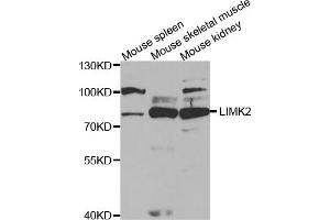 Western blot analysis of extracts of various cell lines, using LIMK2 antibody (ABIN5973137) at 1/1000 dilution. (LIMK2 Antikörper)