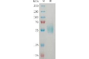Human ST2 Protein, His Tag on SDS-PAGE under reducing condition. (IL1RL1 Protein (AA 19-328) (His tag))