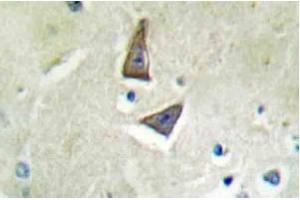 Immunohistochemical analysis using CD4 antibody in Paraffin-embedded human brain tissue. (CD4 Antikörper)