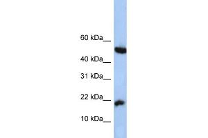 WB Suggested Anti-LOC285033 Antibody Titration: 0. (LOC285033 Antikörper  (N-Term))