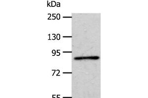 Western Blot analysis of A172 cell using APPL1 Polyclonal Antibody at dilution of 1:600 (APPL1 Antikörper)