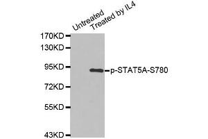 Western blot analysis of extracts from K562 cells using Phospho-STAT5A-S780 antibody (ABIN2987413). (STAT5A Antikörper  (pSer780))