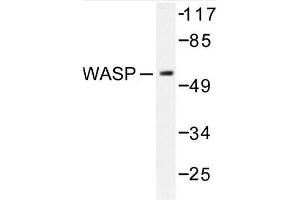 Image no. 1 for anti-Wiskott-Aldrich Syndrome (Eczema-thrombocytopenia) (WAS) antibody (ABIN272092) (WASP Antikörper)