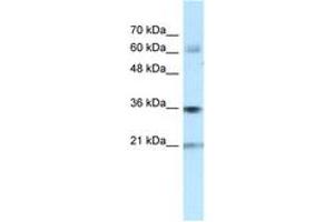 Image no. 1 for anti-Pim-1 Oncogene (PIM1) (N-Term) antibody (ABIN6741658) (PIM1 Antikörper  (N-Term))