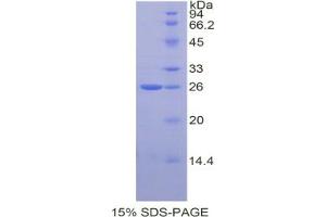 SDS-PAGE analysis of Rat TIMP3 Protein. (TIMP3 Protein)