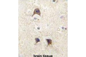 Immunohistochemistry (IHC) image for anti-Leucine-Rich Repeat Containing G Protein-Coupled Receptor 5 (LGR5) (Loop 2) antibody (ABIN2937468) (LGR5 Antikörper  (Loop 2))