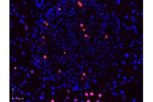 Image no. 1 for anti-Bromodeoxyuridine (BrdU) antibody (ABIN1100302) (BrdU Antikörper)