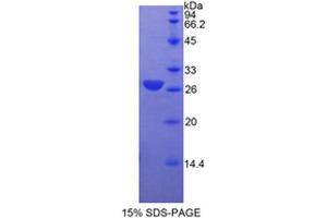 SDS-PAGE (SDS) image for Actin, alpha 2, Smooth Muscle, Aorta (ACTA2) (AA 167-377) protein (His tag) (ABIN3209901) (Smooth Muscle Actin Protein (AA 167-377) (His tag))